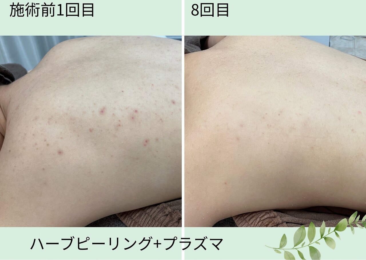カウンセリング重視のオーダーメイド施術